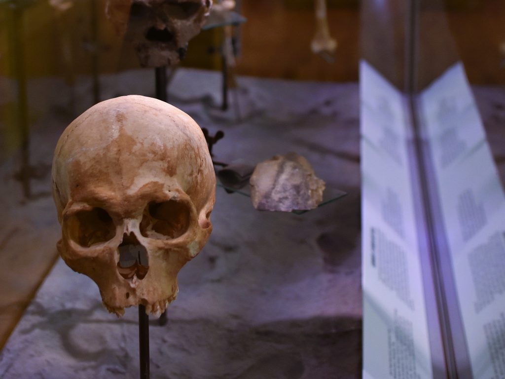 A human skull displayed in a glass case at a museum exhibit, with text panels visible in the background—a fascinating highlight among the best museums Edinburgh has to offer.